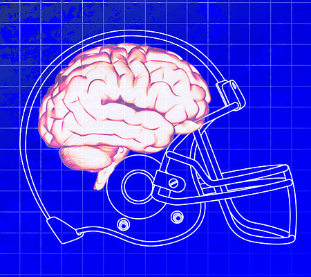 HEALTHY TODAY | Concussions
