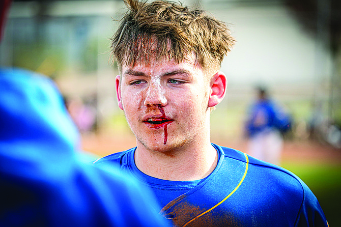 The Lowry High School baseball team makes its home debut this weekend against North Valleys on Friday and a doubleheader with Sparks on Saturday.