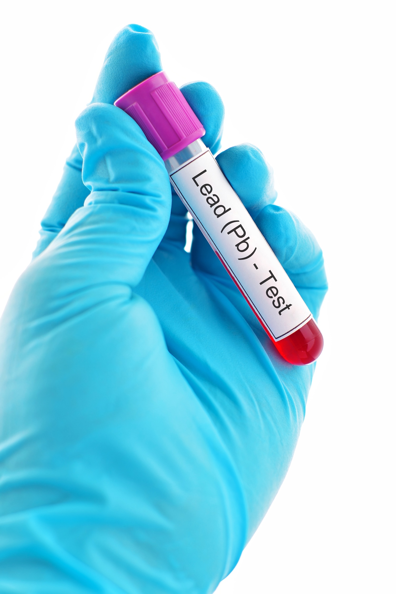 National Lead Poisoning Prevention Week: Protecting children from hidden dangers