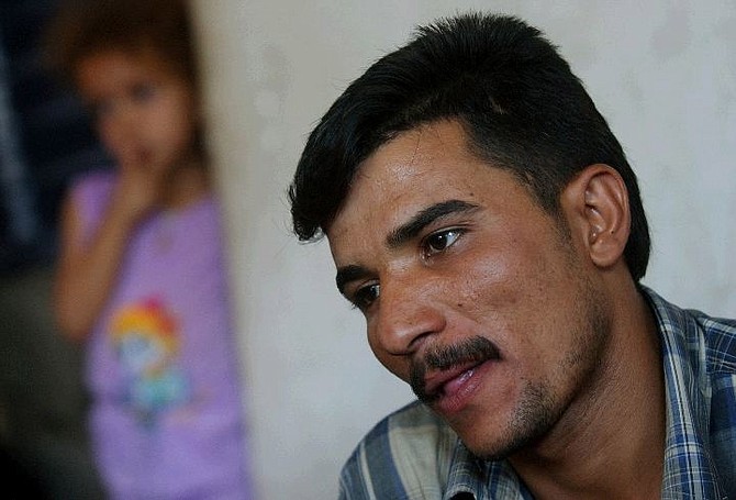 (AP Photo/Hussein Malla)Firas Adnan, his tongue cut off more than a year ago, talks to a reporter in his home in Baghdad, Iraq Wednesday, June 30, 2004. Just before the regime fell, the 24-year-old laborer quarreled with a Saddam loyalist, who punished him by chopping off his tongue.