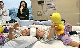 Arlene Aguirre of the Philippines watches her 2-year-old  conjoined twin sons Carl, right, and Clarence in this June 1 file photo at the Children&#039;s Hospital at Montefiore in the Bronx. At left is Dr. David Staffenberg, who is the twins&#039; plastic surgeon.  Associated Press