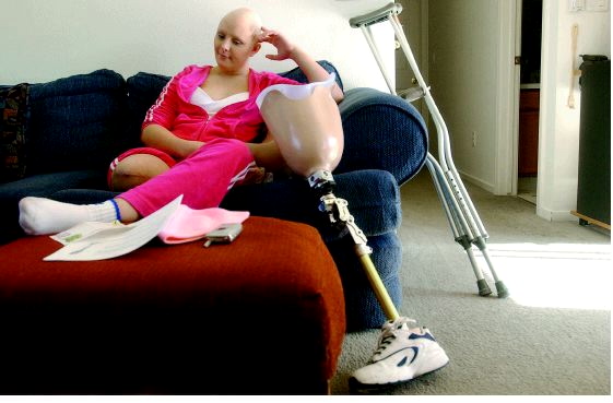 Woman who lost leg to cancer first amputee to land place in Miss World  qualifier - Mirror Online