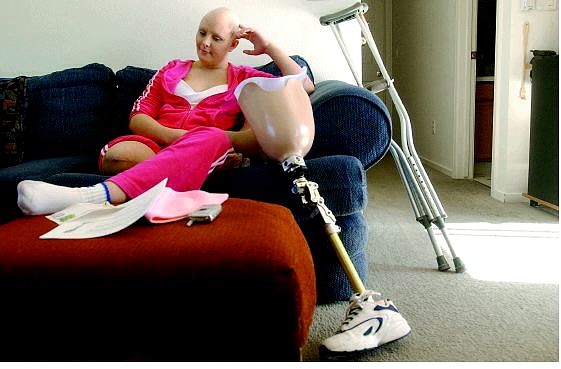 Rick Gunn/Nevada Appeal Once a passionate dancer, Alicia Karau, 20, lost her leg to cancer in June. She is now seeking donations for a state-of-the-art prosthetic leg that will get her dancing again.
