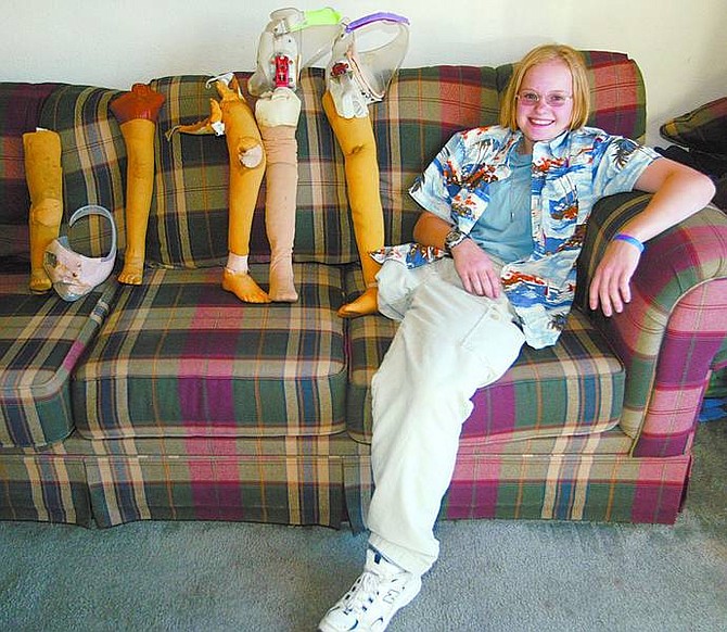 SARAH KING/Nevada Appeal News Service Lenna Fagan, 14, sits with her collection of prosthetic legs she has had over the years. Her family is raising money for a new prosthetic leg.
