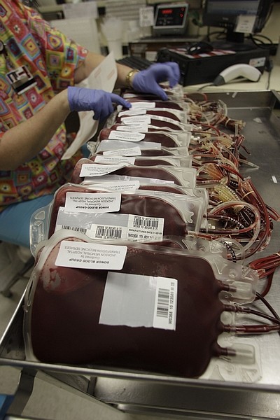 Bags of blood wait to be checked and washed Friday, July 23, 2010 at the Jackson Memorial Hospital in Miami. This summer, hospitals around the country are launching major new research to settle if fresher blood really is better for at least some patients. And if so, they&#039;re also hunting ways to turn back the clock for older blood _ like the University of Miami&#039;s work to wash away some cellular debris _ and offset any deterioration. The University of Miami at Jackson Memorial Hospital is testing whether &quot;washing&quot; blood before transfusing it could help, by ridding blood of microparticles that accumulate the longer it&#039;s stored.  (AP Photo/J Pat Carter)