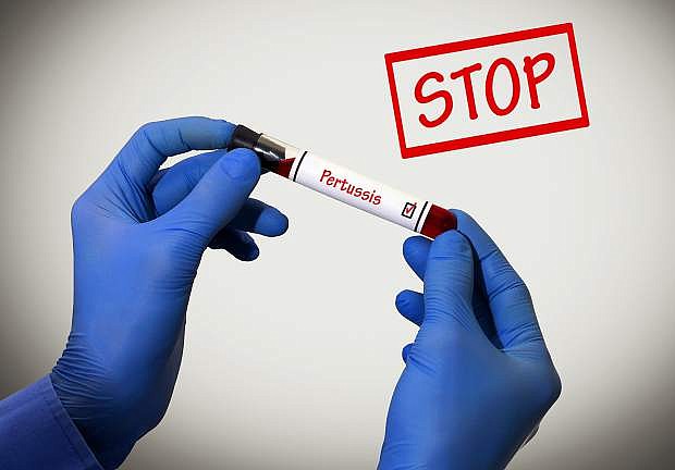 Stop pertussis. Positive result of blood test. Test tube with a blood test in the doctor&#039;s hands. Medical concept.