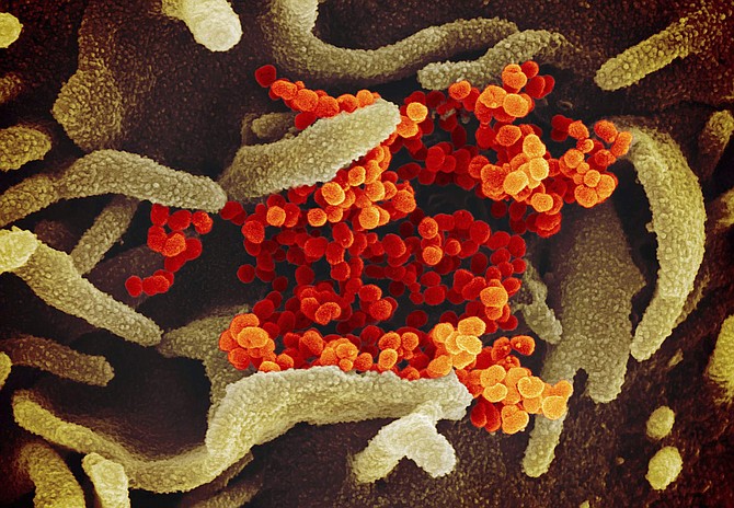 This undated electron microscope image made available by the U.S. National Institutes of Health in February 2020 shows the Novel Coronavirus SARS-CoV-2, orange, emerging from the surface of cells, green, cultured in the lab. Also known as 2019-nCoV, the virus causes COVID-19. The sample was isolated from a patient in the U.S. (NIAID-RML via AP)