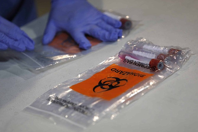 Nasal swab coronavirus testing kits sit on a table during a tour of a new temporary coronavirus testing site Monday, Aug. 3, 2020, in Las Vegas. 