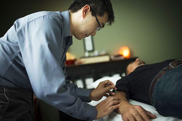 Dr. Justin Chang of Renown Health in Reno performs acupuncture on a patient.